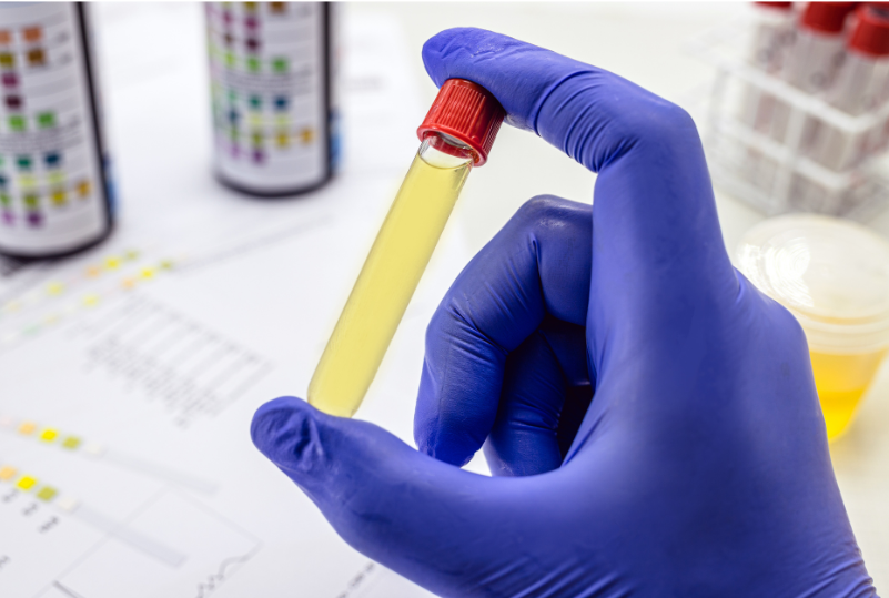 Blue gloved hand holding a vial of liquid in a toxicology lab.